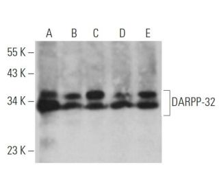 Anti Darpp 32 Antibody H 3 Scbt Santa Cruz Biotechnology