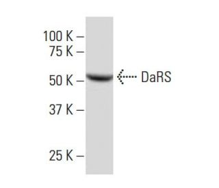 DaRS Antibody (14S6) - Western Blotting - Image 34350 