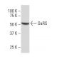 DaRS Antibody (14S6) - Western Blotting - Image 34350 