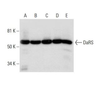 DaRS Antibody (H-3) - Western Blotting - Image 294472 