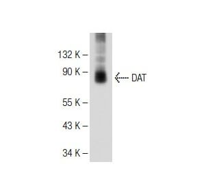 DAT Antibody (6-5G10) - Western Blotting - Image 109574