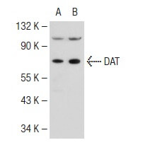 DAT Antibody (6-8D6) | SCBT - Santa Cruz Biotechnology