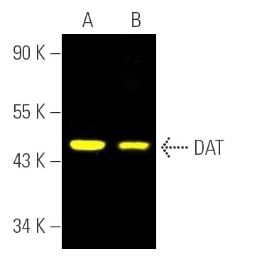 DAT Antibody (6-8D6) | SCBT - Santa Cruz Biotechnology
