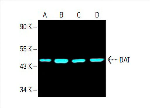 DAT Antibody (6-8D6) | SCBT - Santa Cruz Biotechnology