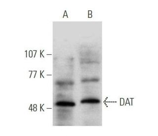 DAT Antibody (6-8D6) - Western Blotting - Image 356245