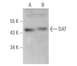 DAT Antibody (6-8D6) - Western Blotting - Image 361007