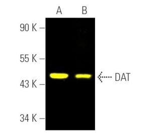 DAT Antibody (6-8D6) - Western Blotting - Image 391200