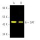 DAT/Dopamine Transporter/SLC6A3抗体 (6-8D6) | SCBT - Santa Cruz Biotechnology