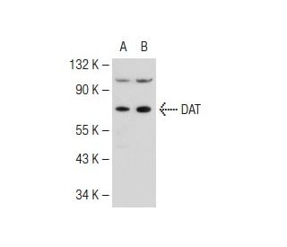 western blotting image from recommended DAT/Dopamine Transporter/SLC6A3 (6-8D6) monoclonal antibody replacement. Image 109575