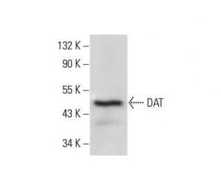 DAT/Dopamine Transporter/SLC6A3 Antibody (hDAT-LOOP) - Western Blotting - Image 303896 