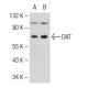 western blotting image from recommended DAT/Dopamine Transporter/SLC6A3 (6-8D6) monoclonal antibody replacement. Image 109575