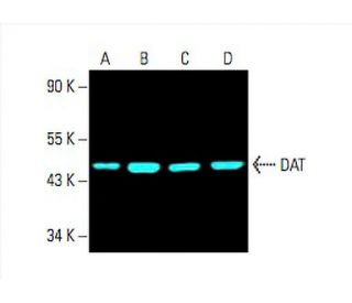 DAT/Dopamine Transporter/SLC6A3 Antibody (6-8D6) - Western Blotting - Image 393138