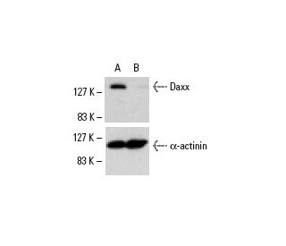 Daxx siRNA (h): sc-35178. Western blot analysis of Daxx expression in non-transfected control (A) and Daxx siRNA transfect 