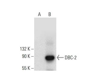 DBC-2 Antibody (G-12) - Western Blotting - Image 308371