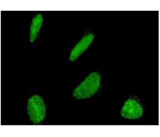 immunofluorescence image from recommended Dbf4 (6G9) monoclonal antibody replacement. Image 346139