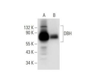 western blotting image from recommended DBH (A-9) monoclonal antibody replacement. Image 295717