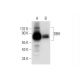 western blotting image from recommended DBH (A-9) monoclonal antibody replacement. Image 295717