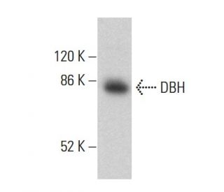 DBH Antibody (A-9) - Western Blotting - Image 360249The Double Nickase Plasmid features a U6 promoter for sgRNA expression, a 20 nt targeting sequence, and a gRNA scaffold to guide Cas9n. It includes a CBh promoter for Cas9n (D10A) and puromycin resistance, GFP for transfection verification, and nuclear localization signals (NLS). The 2A peptide allows co-expression of Cas9n and Puro from a single promoter, enabling precise genome editing with reduced off-target effects.
