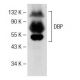 western blotting image from recommended DBP (A-5) monoclonal antibody replacement. Image 141533