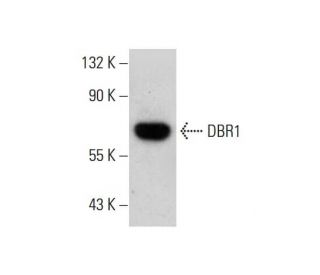 DBR1 Antibody (3A7) - Western Blotting - Image 384238 