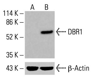 DBR1 Antibody (3A7) - Western Blotting - Image 416131 