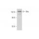 Dbs Antibody (C-7) - Western Blotting - Image 312853 