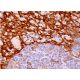 Dieser polyklonale Antikörper wird nicht mehr hergestellt. Wir empfehlen Ihnen unseren <a href="dc-sign-antibody-dc28">DC-SIGN (DC28)</a> monoklonalen Antikörper (Beispielsdaten werden angezeigt). immunohistochemistry image from recommended DC-SIGN (DC28) monoclonal antibody replacement. Image 383641