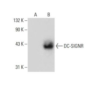 DC-SIGNR Antibody (H-2) - Western Blotting - Image 132716