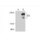 DCC Antibody (A-1) - Western Blotting - Image 393585