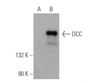 western blotting image from recommended DCC (A-1) monoclonal antibody replacement. Image 368618