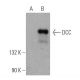 western blotting image from recommended DCC (A-1) monoclonal antibody replacement. Image 368618