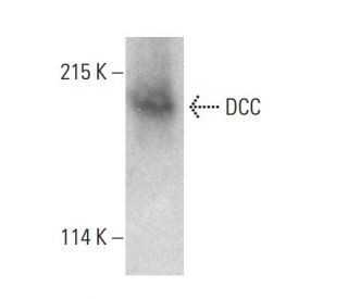 DCC Antibody (A-1) - Western Blotting - Image 387989The Double Nickase Plasmid features a U6 promoter for sgRNA expression, a 20 nt targeting sequence, and a gRNA scaffold to guide Cas9n. It includes a CBh promoter for Cas9n (D10A) and puromycin resistance, GFP for transfection verification, and nuclear localization signals (NLS). The 2A peptide allows co-expression of Cas9n and Puro from a single promoter, enabling precise genome editing with reduced off-target effects.