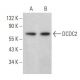 DCDC2 Antibody (E-11) - Western Blotting - Image 359117 