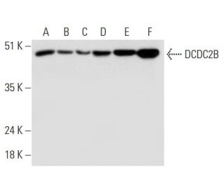 DCDC2B Antibody (E-6) - Western Blotting - Image 331160 