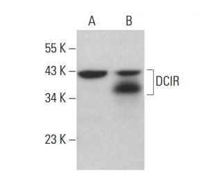 DCIR Antibody (G-9) - Western Blotting - Image 378121 