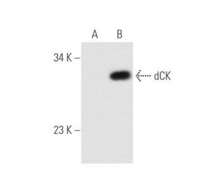 dCK Antibody (2243C2) - Western Blotting - Image 58309