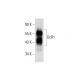 western blotting image from recommended DcR1 (C-6) monoclonal antibody replacement. Image 144839