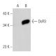 DcR3 Antibody (4H77) - Western Blotting - Image 31024 
