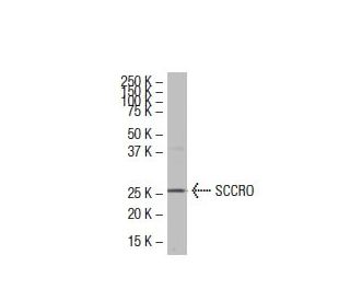 Dcun1D1 Antibody (3E1) - Western Blotting - Image 33484 