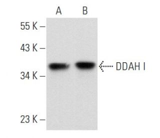 DDAH I Antibody (D-6) - Western Blotting - Image 356874 