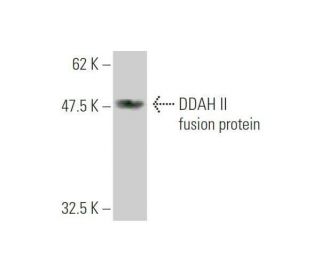 western blotting image from recommended DDAH II (3E3) monoclonal antibody replacement. Image 349546