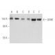 This polyclonal antibody has been discontinued. See our recommended <a href="ddb1-antibody-e-11">DDB1 (E-11)</a> monoclonal antibody (sample data shown). western blotting image from recommended DDB1 (E-11) monoclonal antibody replacement. Image 356722