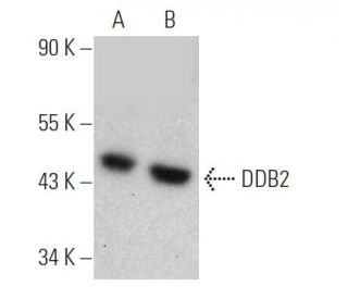 western blotting image from recommended DDB2 (2246C4a) monoclonal antibody replacement. Image 368218
