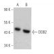 western blotting image from recommended DDB2 (2246C4a) monoclonal antibody replacement. Image 368218