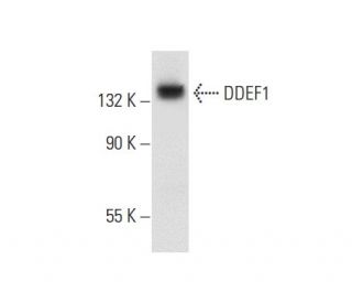 DDEF1 Antibody (E-12): sc-374411