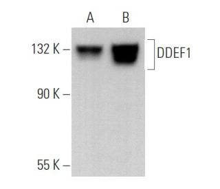 DDEF1 Antibody (E-12) - Western Blotting - Image 366592 