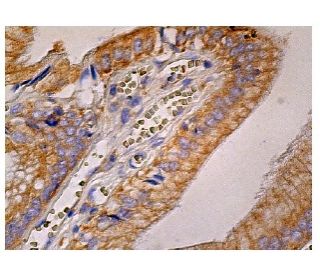 DDR1 Antibody (48B3) - Immunohistochemistry - Image 260785 