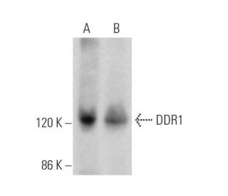 western blotting image from recommended DDR1 (C-6) monoclonal antibody replacement. Image 374716