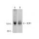 western blotting image from recommended DDR1 (C-6) monoclonal antibody replacement. Image 374716