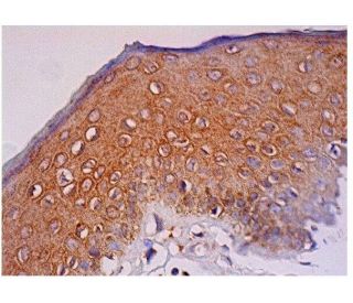 immunohistochemistry image from recommended DDR2 (3B11E4) monoclonal antibody replacement. Image 284815
